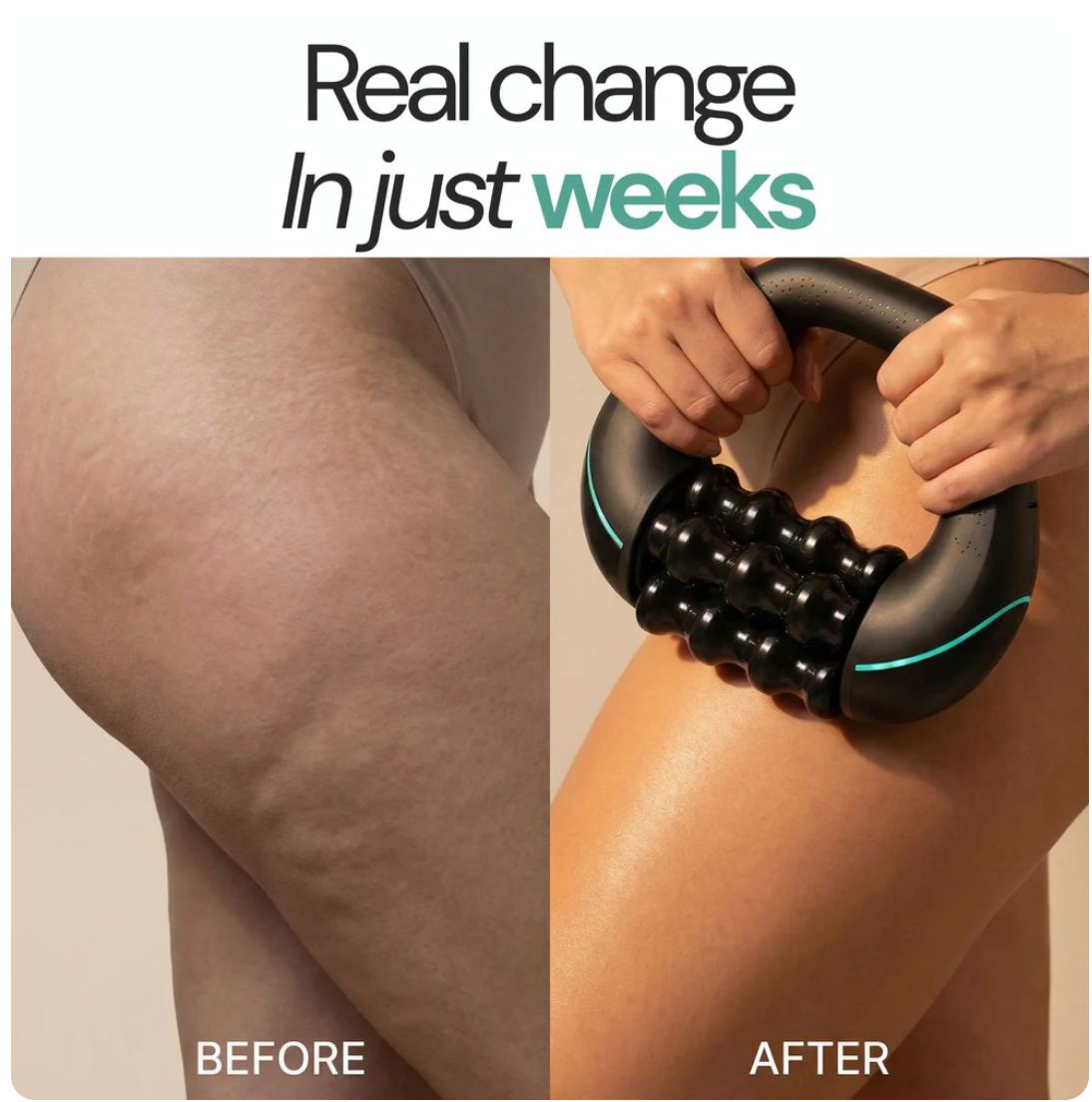 TEIFAR BodySculpt™